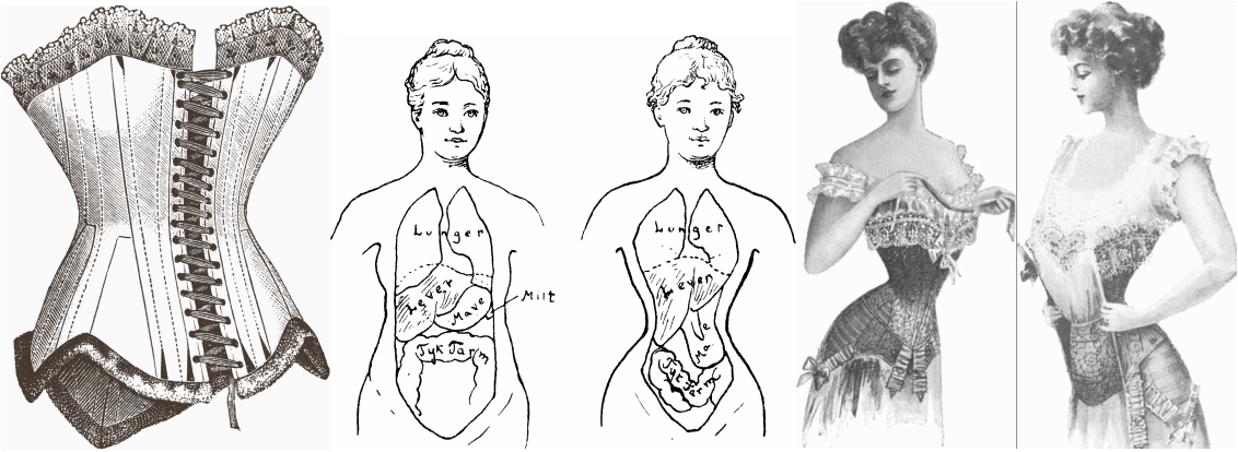 WikiVictorian on X: Dress reformers argued that women's bodies were  deformed by fashion; and most people today perceive the corset as having  been an instrument of women's oppression.  / X